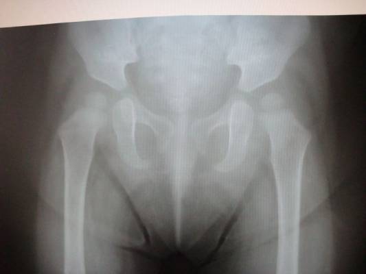 ��������� �������� ��������� ������������� �������� ������� 1 ���.