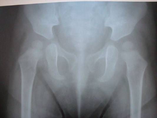 ��������� �������� ��������� ������������� �������� ������� 1 ���.